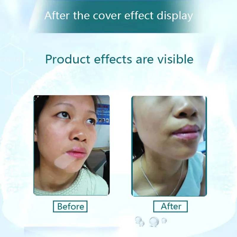 Набор для ремонта шрамов набор кремов ухода за кожей консилеров покрытия