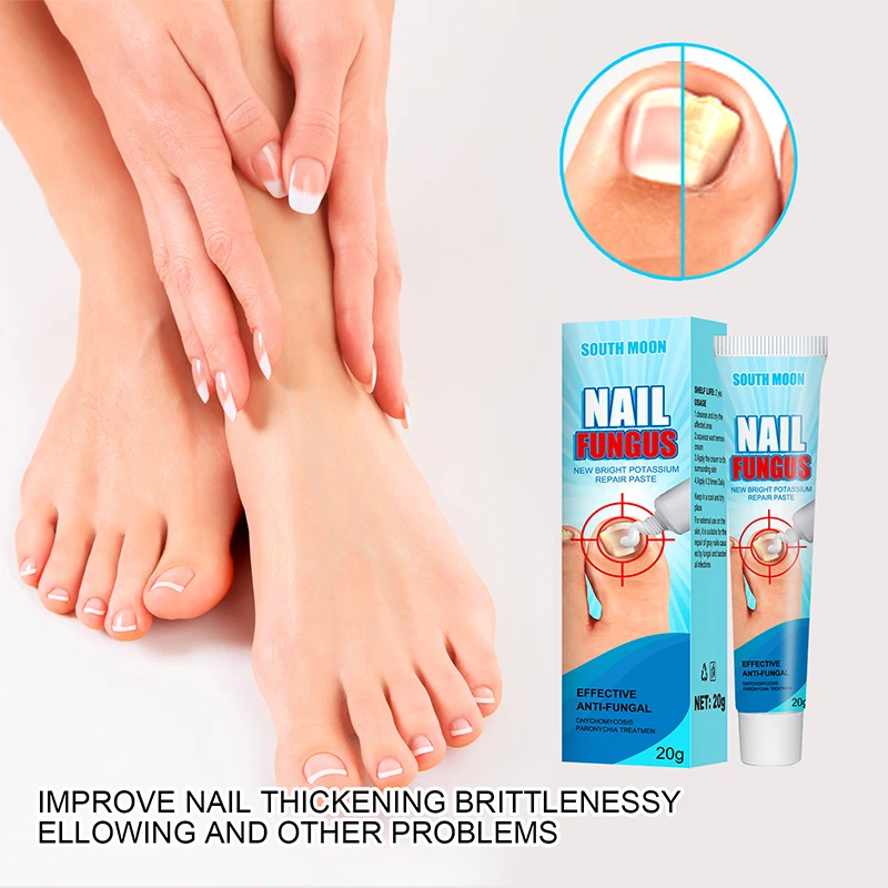 

20g Onychomycosis Repair Cream Antibacterial Nail Nail Care Ointment Nail Cream For Nail Care Tool