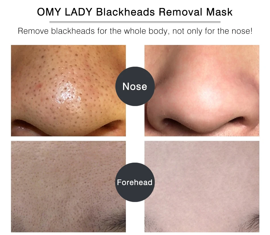

OMY LADY Black Mask Peel Off Bamboo Charcoal Purifying Blackhead Remover Mask Deep Cleansing for AcneScars Blemishes
