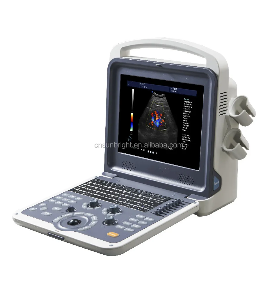 

Portable 4D color doppler echo machine & CE hospital doppler ultrasound