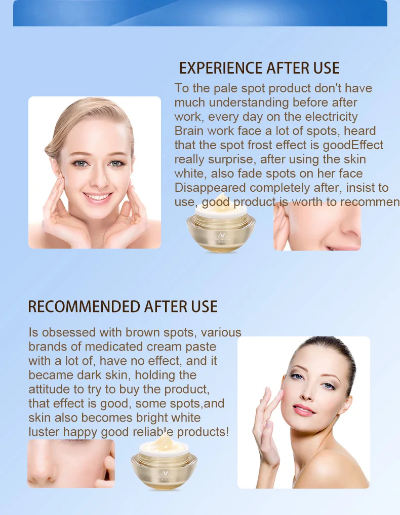 

Meiyanqiong Freckle Cream Effective Remove Spots Melanin Whitening Repair Anti-Aging Moisturizing Cream Skin Care Face Care 30g