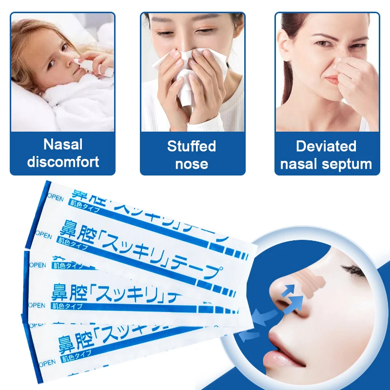 

Rhinitis Sinusitis Ointment Allergic Inflammation Cream Breath Nasal Strips Nasal Sneezing Runny Antipruritic Nasal Congestion