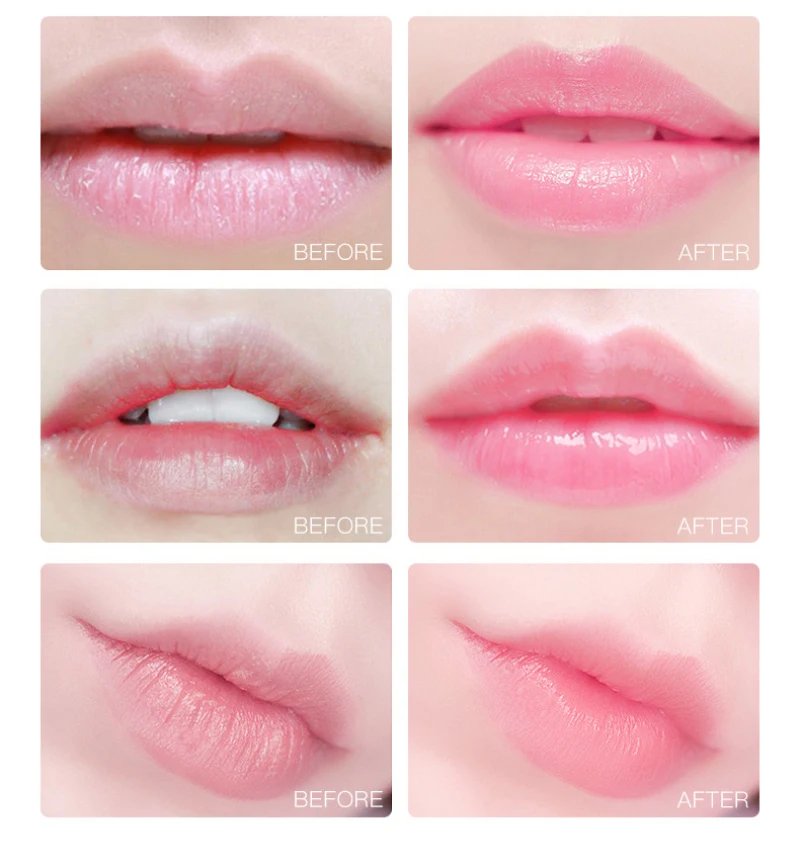 

20 pcs/box Cherry Hydrating Moisturizing Lip Mask Anti-Drying Lightening Lip Lines Lip Enhancer Plumper Lip Care