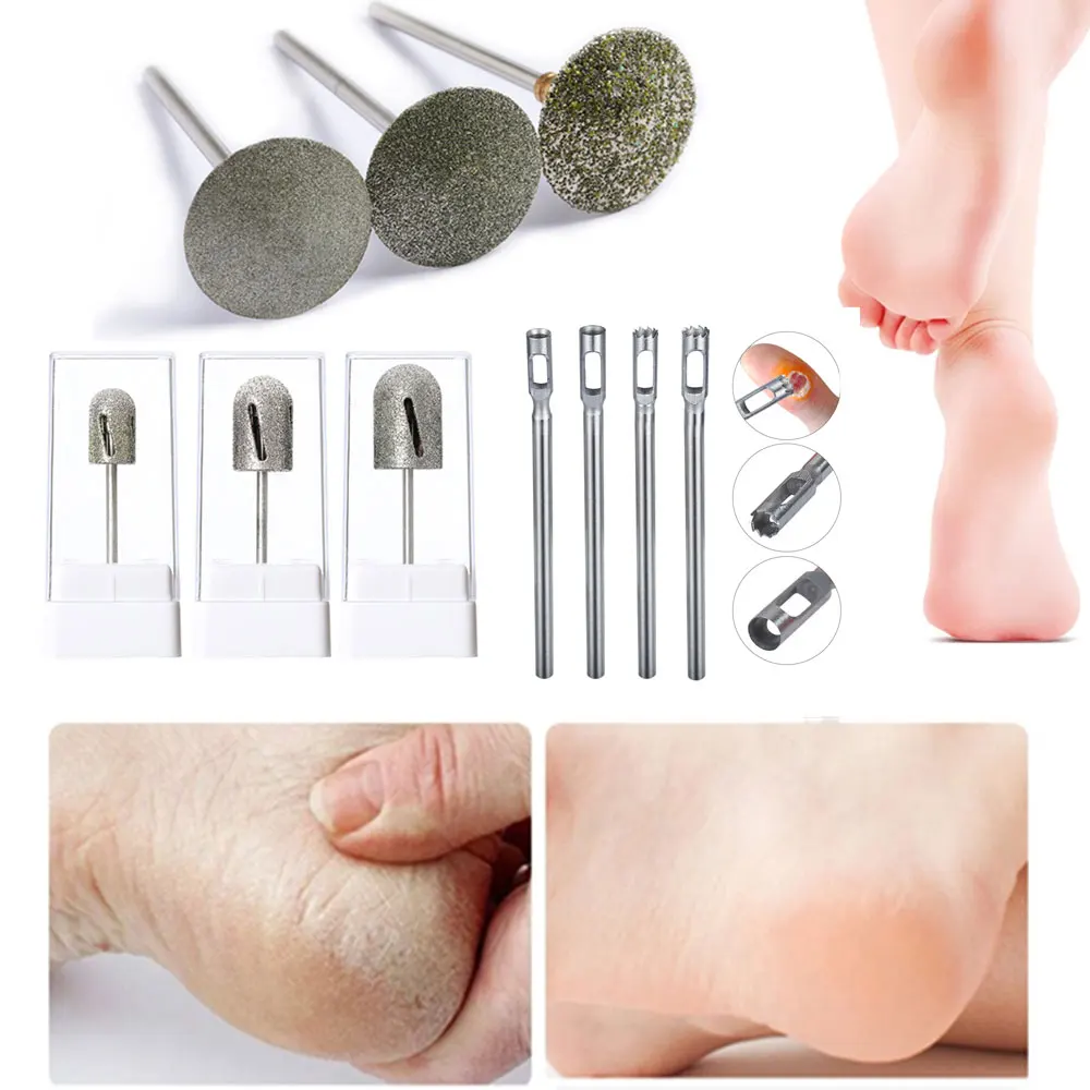 Алмазная насадка для педикюра мозоль кутикула ног аксессуары фреза вращающиеся
