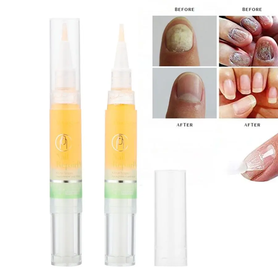 2 шт. масло для ремонта ногтей Удаление грибка Сыворотка против лечение