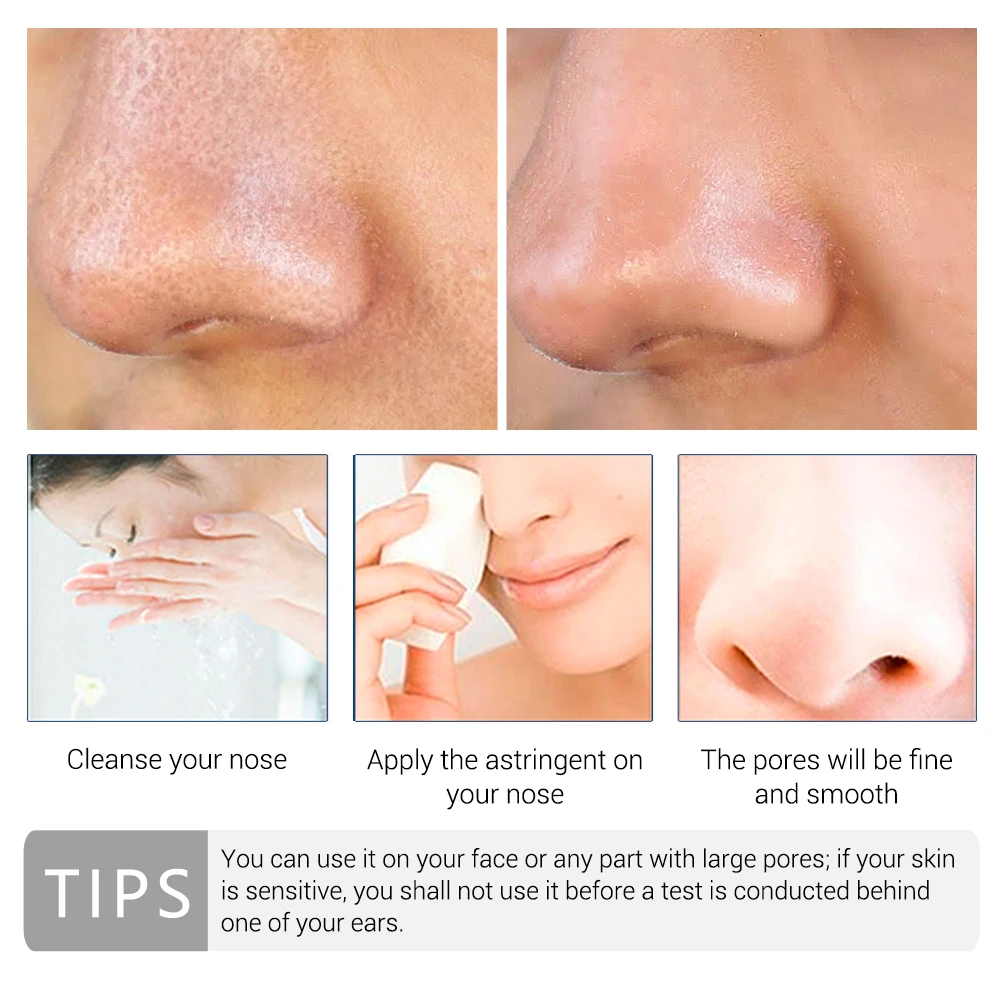 LANBENA лечение пор сывороточная эссенция уменьшение сухости контроль жирности