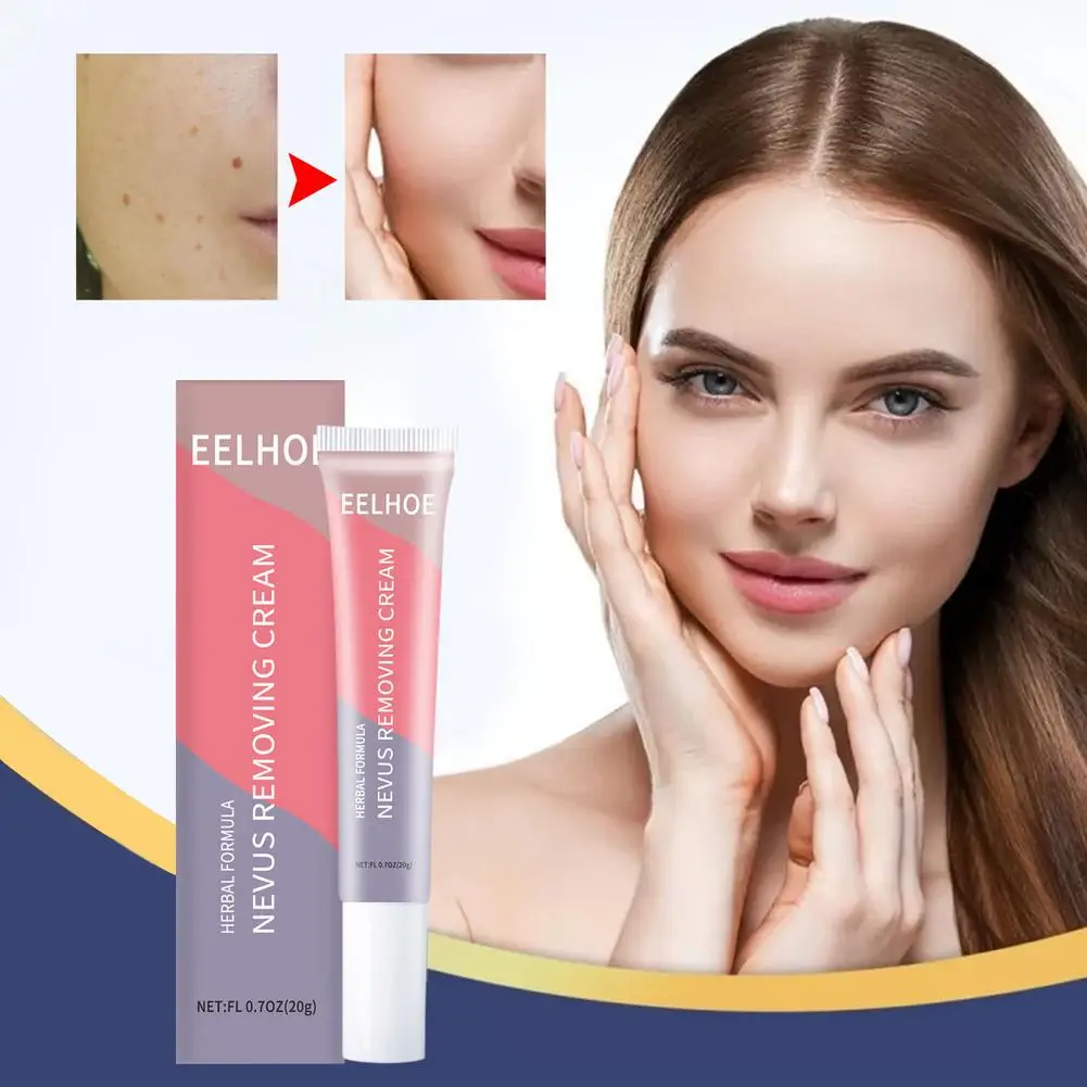 

20g Warts Remover Antibacterial Ointment Wart Cream Skin Tag Remover Herbal Extract Corn Plaster Warts Ointment