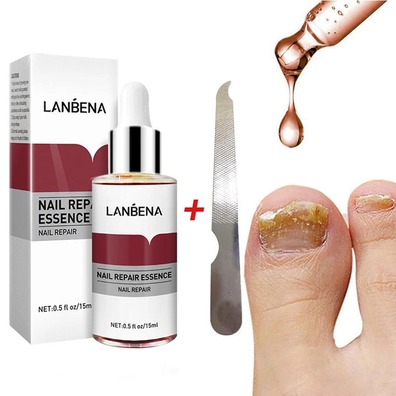 

Bright Fungal Nail Repair Onychomycosis Removal Essence Anti Infection Foot Nail Care Nail Treatment Cream Foot Care 15ml