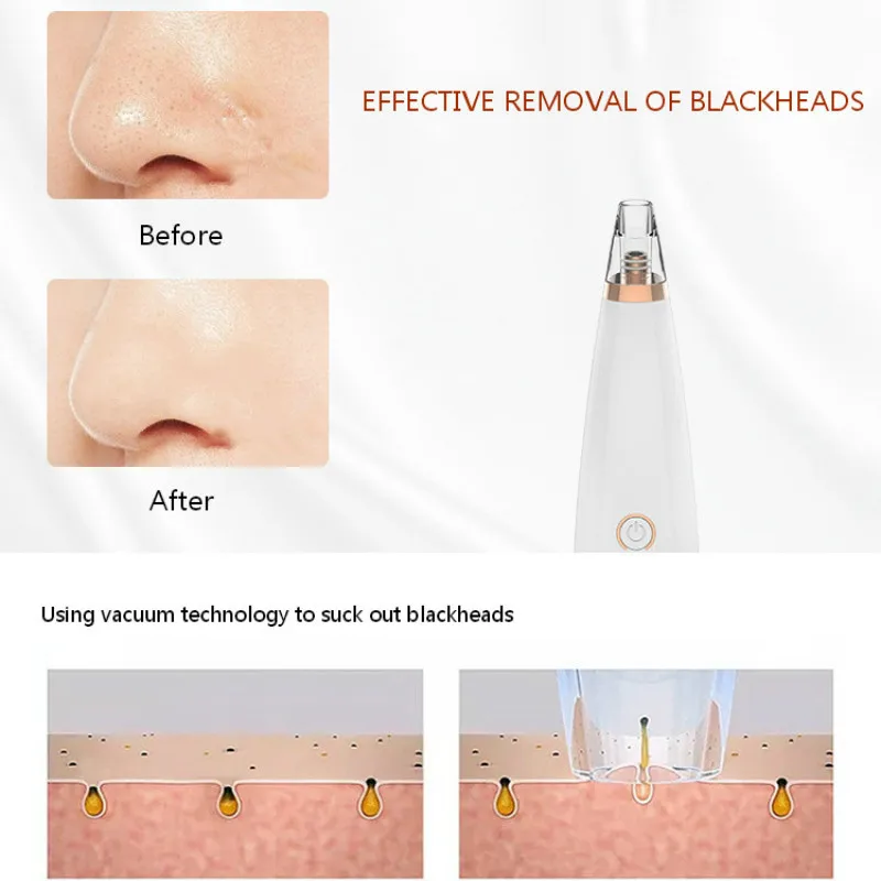 Электрический вакуумный прибор для удаления угрей черных пор всасывающий и