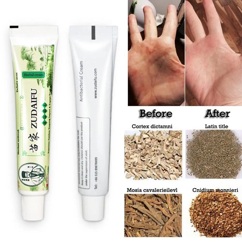 Zudaifu Body Cream Without Retail Box Men Women Skin Care Product Relieve Psoriasis Dermatitis Eczema Pruritus Effect |