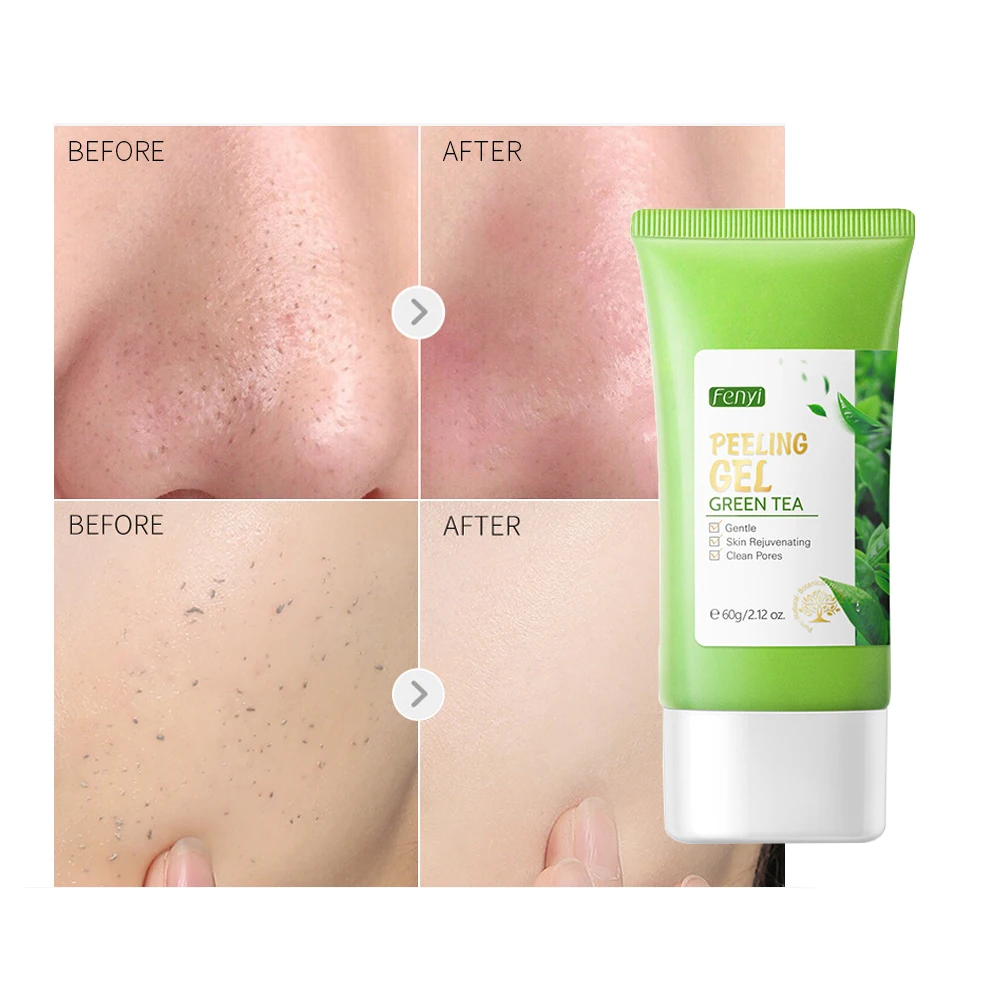 

Facial Exfoliating Cream Peeling Gel Face Scrub Deep Remove Cleaning All Skin Types Smooth Moisturizing Skin Exfoliator Cream
