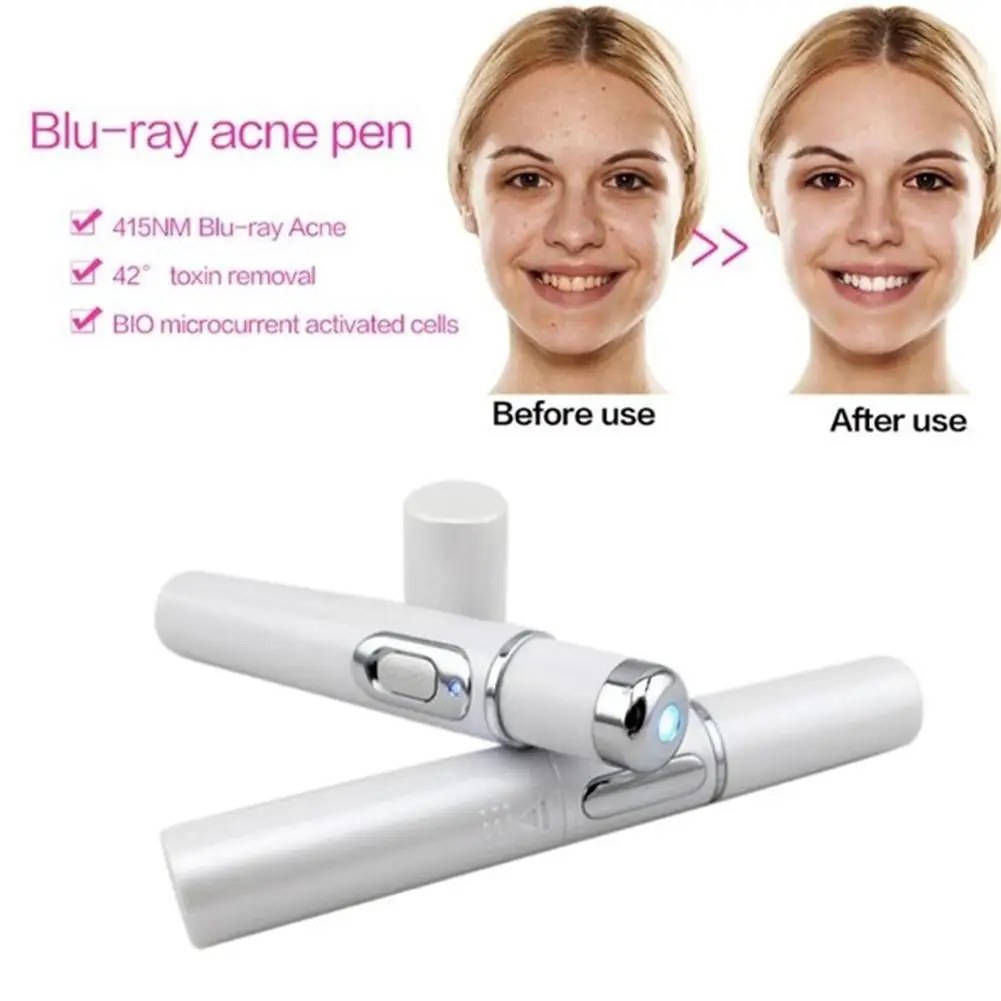 HobbyLane Blu-ray Acne Removing Blue Light Pen Scar Removal Anti Wrinkle Aging Therapy Beauty Device Face Machine Hot | Красота и