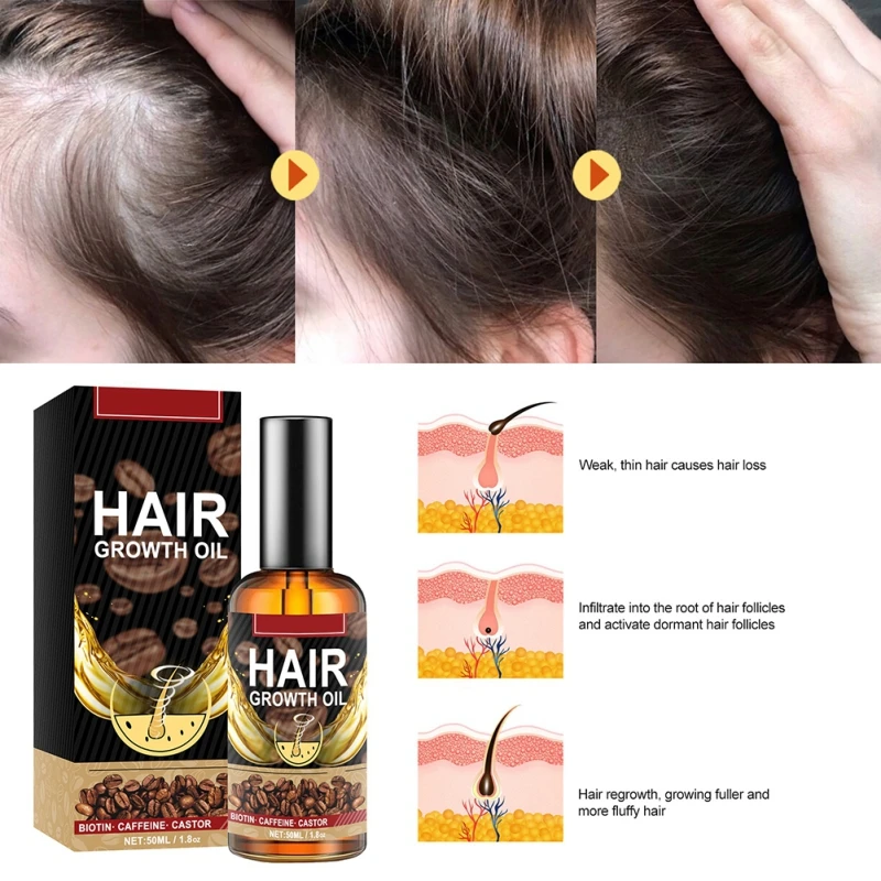 

Спрей REDDHOON против выпадения волос, средство для ухода за волосами, сыворотка для роста волос с сухими и пушистыми волосами