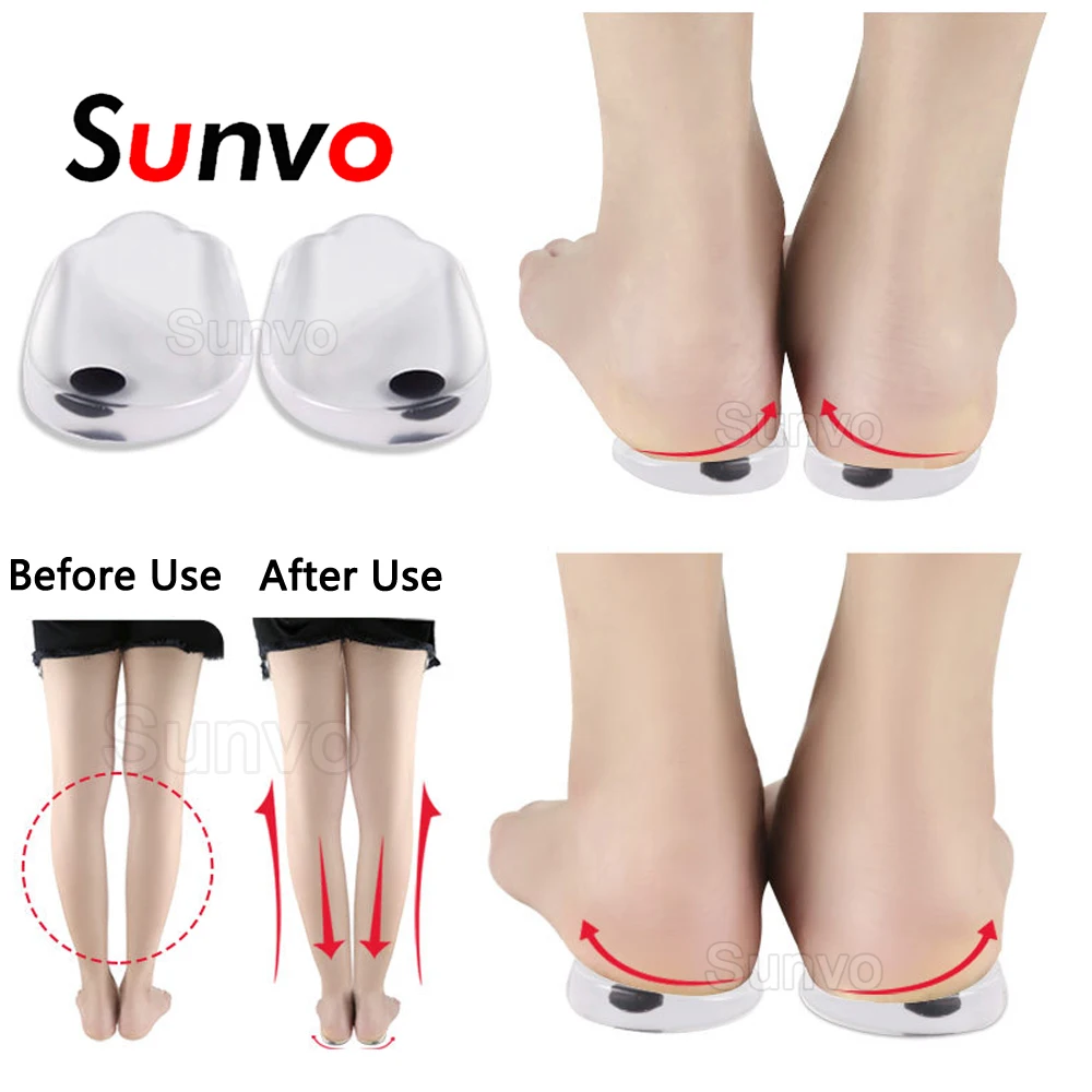 Силиконовые гелевые пяточные вкладыши для коррекции O/X формы ног ортопедические