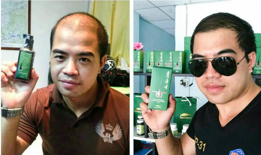 

Original Neo Hair Lotion Hair Root HAIR BEARD SIDEBURNS LONGER Stronger Herbs Treatment 100% Thailand 120ml FDA