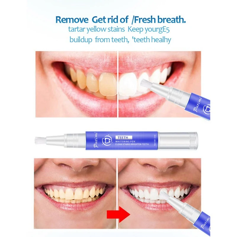 

Recommend Effctive Whiten Teeth Oral Hygiene Teeth Whitening Pen Cleaning Serum Remove Plaque Stains Dental Tools