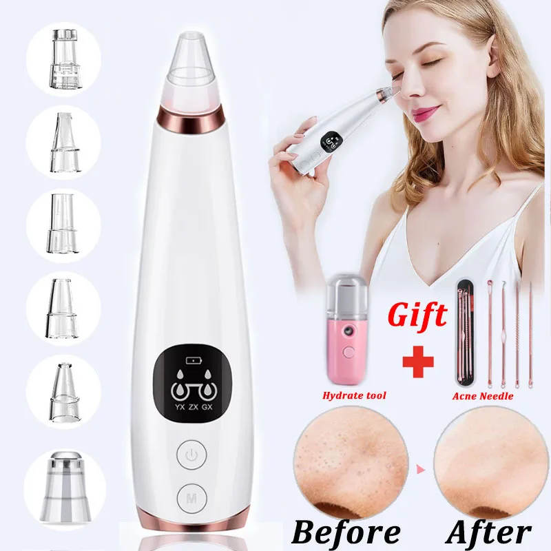 

ABAY Blackhead Remover Face Beauty Deep Nose Cleaner T Zone Pore Acne Pimple Removal Vacuum Suction Facial Clean Skin Tool
