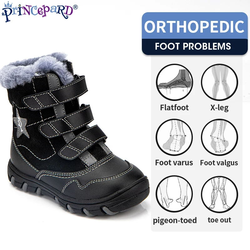 Princepard Winter Waterproof Fur Boots Children Orthopedic Supportive Shoes for Correcting Flat Feet Foot Varus Valgus EU22-27