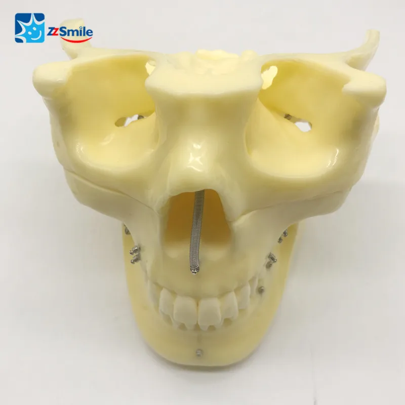 

M2016 Implant Practice Model For Showing the Exact Position for Ortho Implant