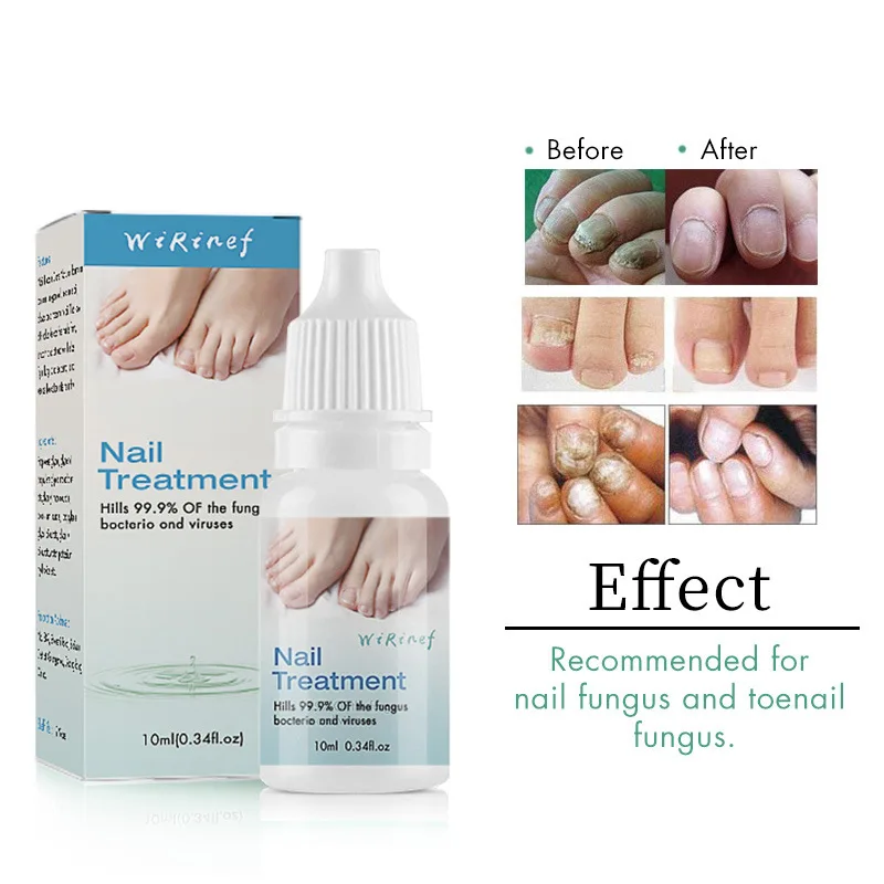 

Nail Repair Liquid Nail Broken Essence 10ml Repair Nail Growth Water Prolong the nail bed and effectively repair the nail surfac
