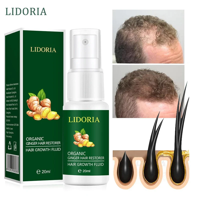 Имбирный спрей для роста волос быстрорастущие эфирные масла предотвращающие