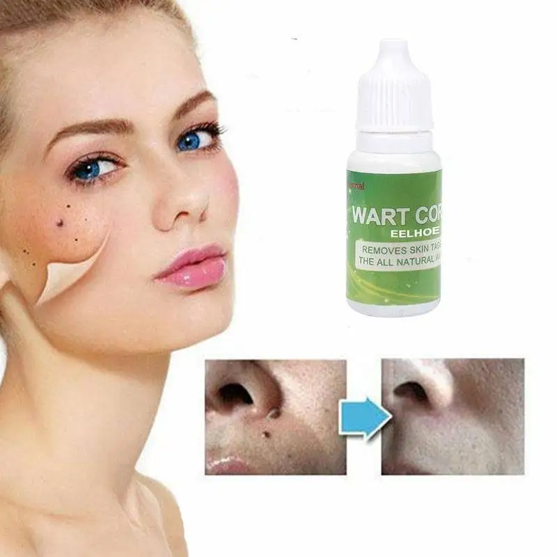 

Liquid Wart Mole Skin Tag Remover Wipe Off Blackspot Freckle Ance Removal Solution Wart Treatment Beauty Skin Care Tools