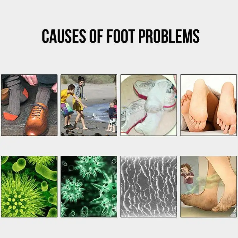 100 мл обувь дезодорант спрей для ног пот воняет домашние Защитные носки очистки