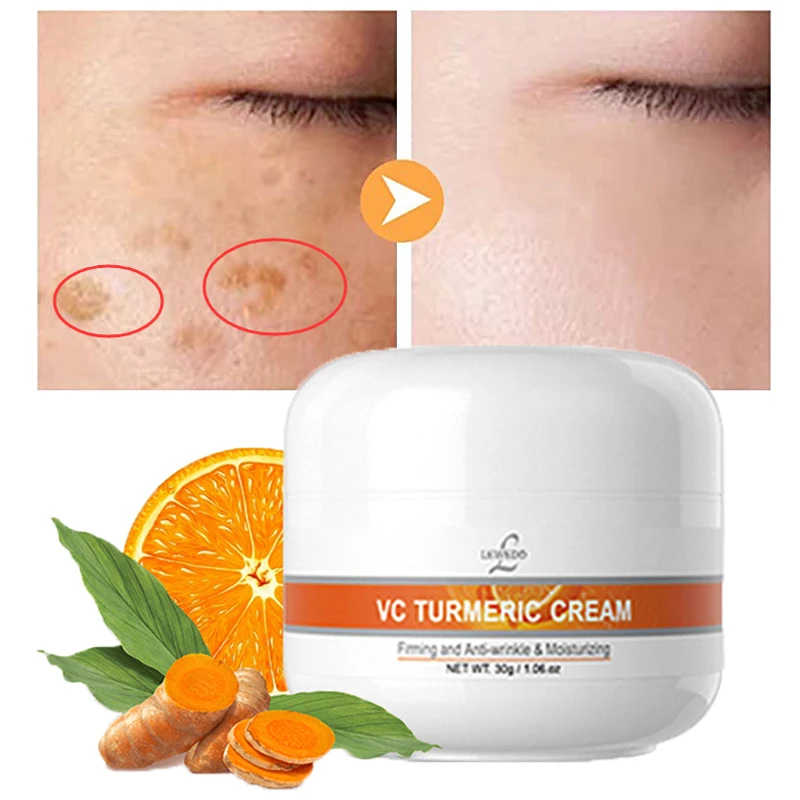 

Lewedo для отбеливания веснушек Face Cream VC для удаления темных пятен Fades морщин, увлажняющий, средство для ухода за лицом, средство для осветления ...
