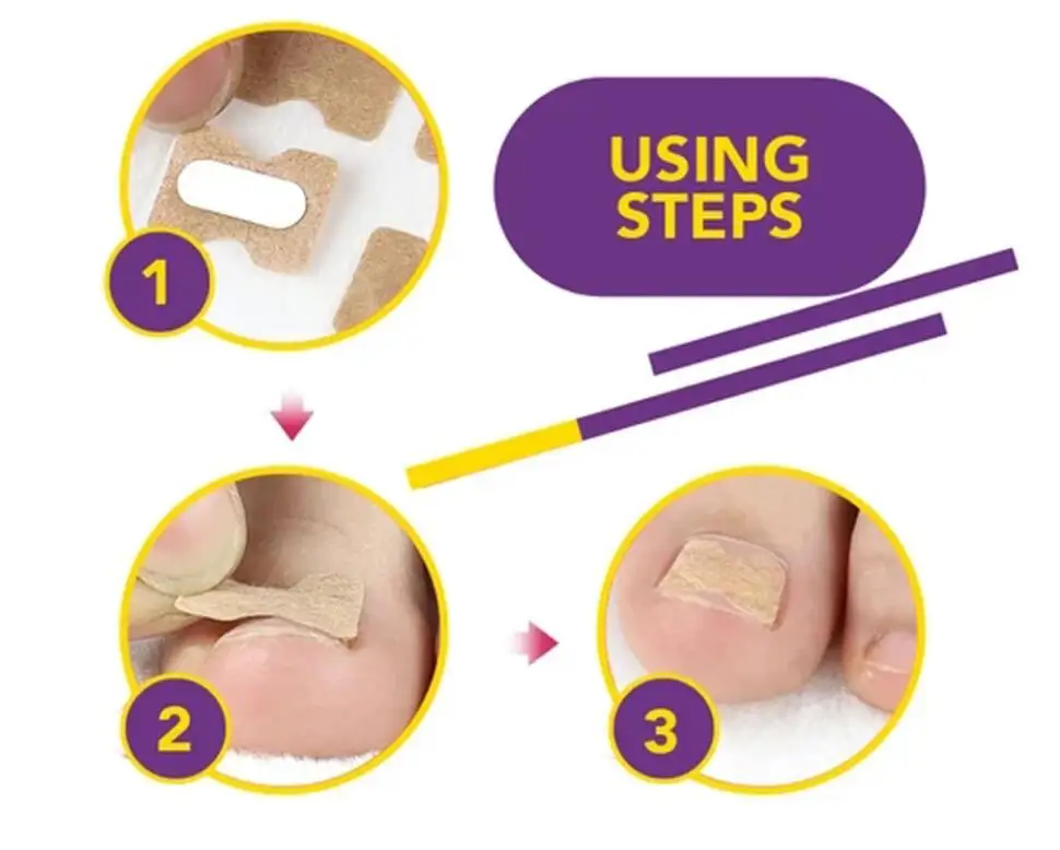 20/60 шт. пластыри для коррекции вросших ногтей | Красота и здоровье