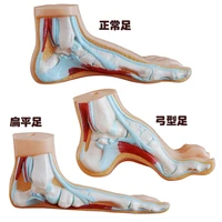 11life sized human normal flat arched foot model foot arch model anatomy teaching model