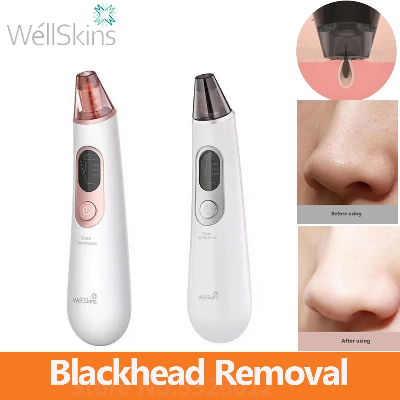 

Wellskins Electric Blackhead Removal Deep Pore Cleaner Acne Pimple Removal Vacuum Suction Facial SPA Face Care Tools