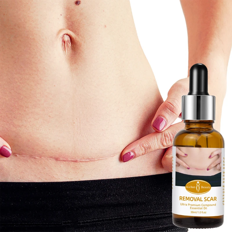

Lavender Essence Scar Repair Skin Essential Oil Pure Natural Remove Stretch Marks Acne Scar Treatment Moisturizing Skin Care 30g