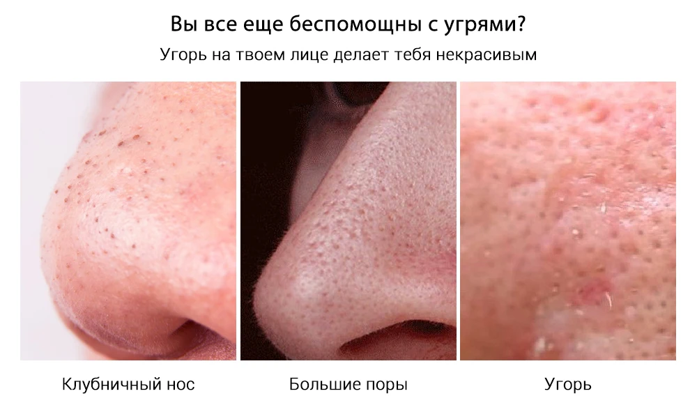 LANBENA, маска для удаления черных точек, маска для носа, полоска пор, черная маска для лица, лечение акне, глубокое очищение лица, уход за кожей