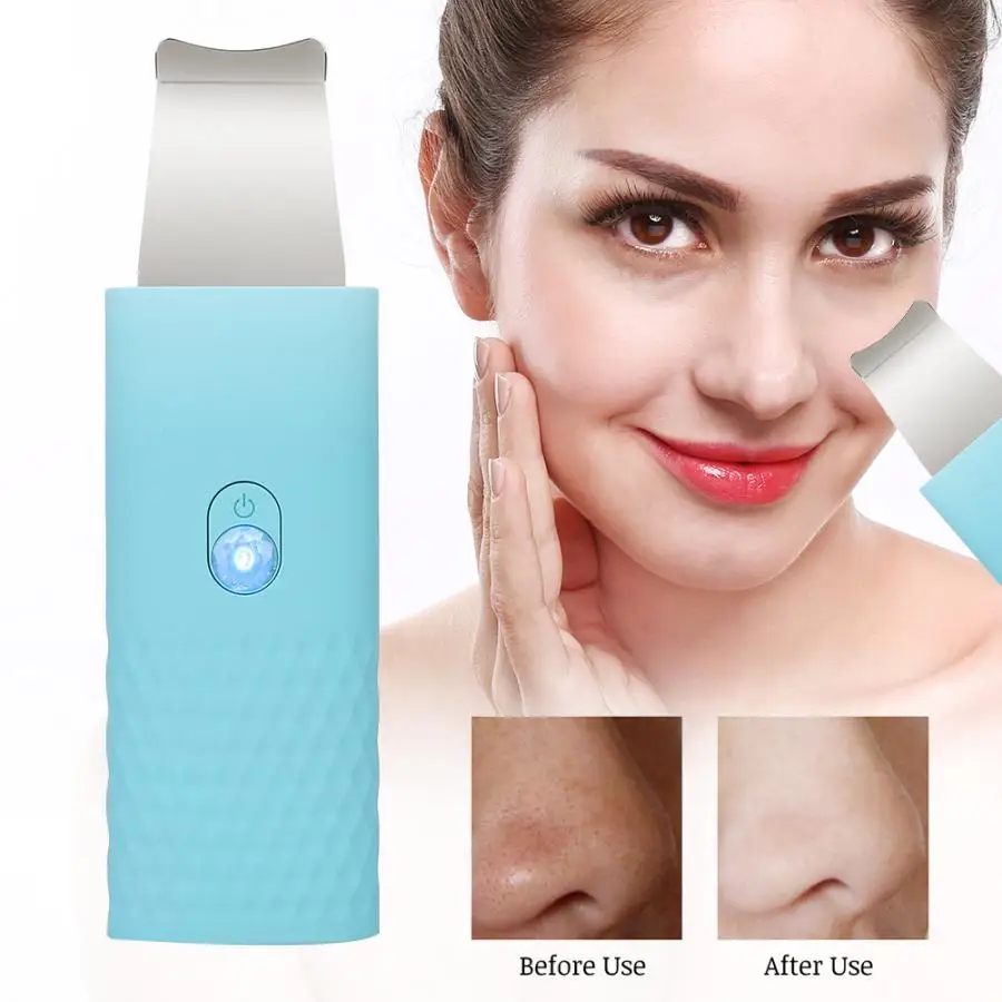 Портативное средство для очистки лица отшелушивания удаления черных точек акне