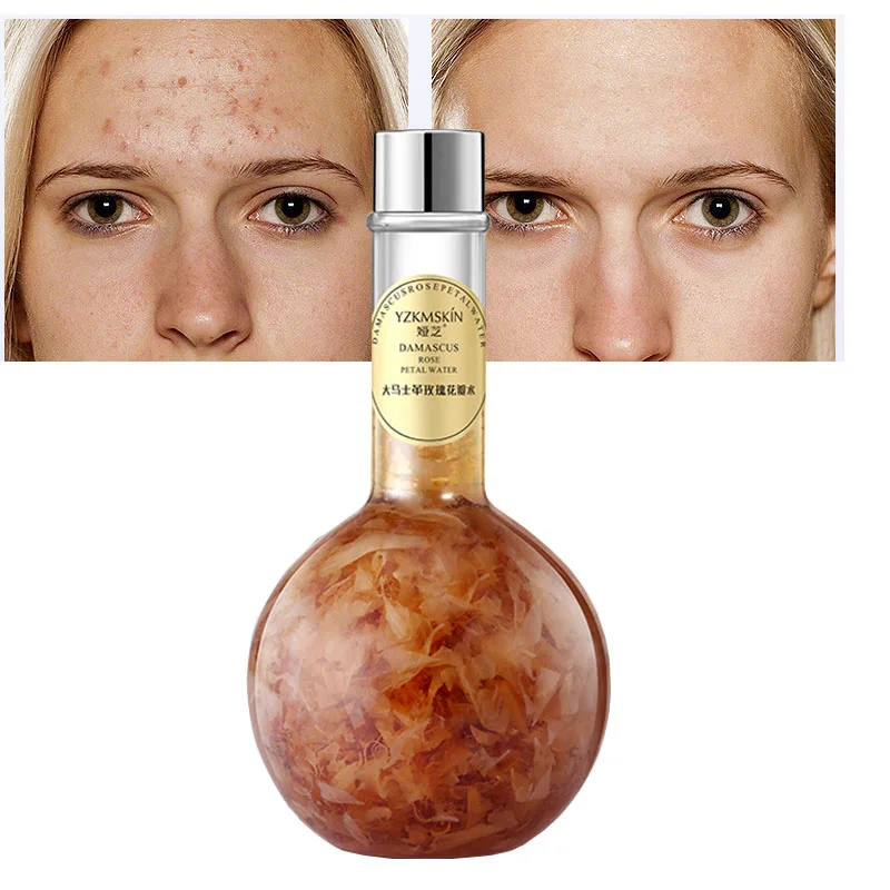 

Repair Face Toner For Acne Oily Skin Rose Petal Tonic Water Refreshing Firm Shrink Pores Moisturizing Rose Hydrosol Korean 360ML