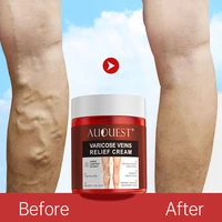 auquest herbal varicose veins cream treatment vasculitis phlebitis spider pain relief ointment removal remedy cream women men