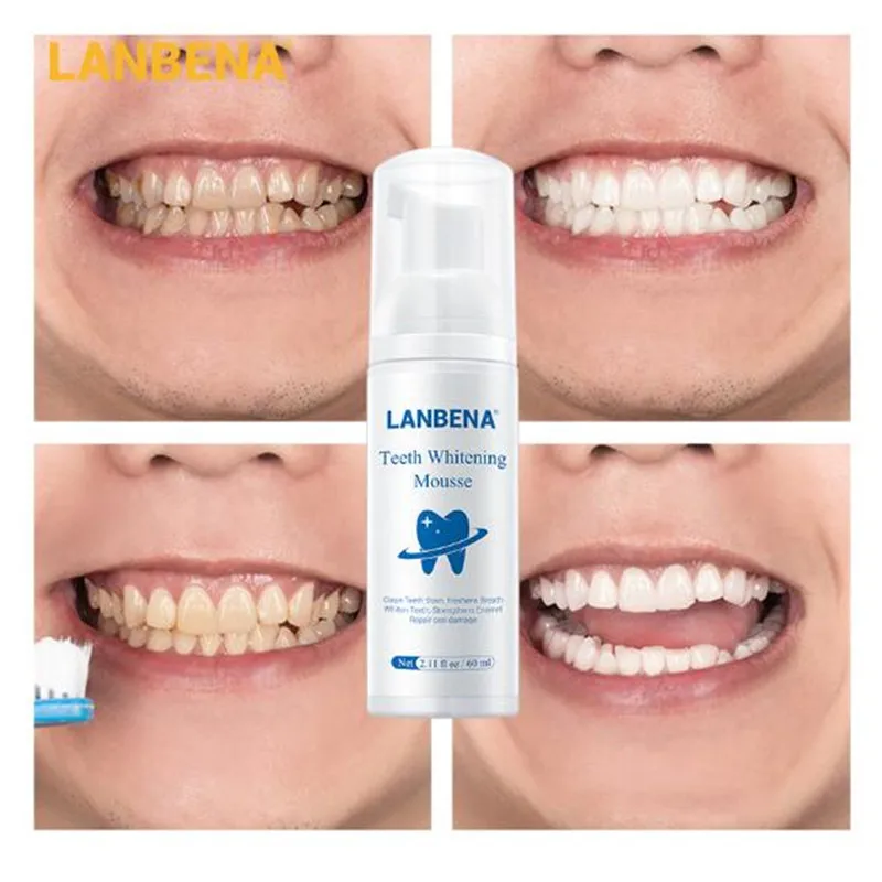 Отбеливатель зубов LANBENA мусс для отбеливания инструмент чистки гигиена полости