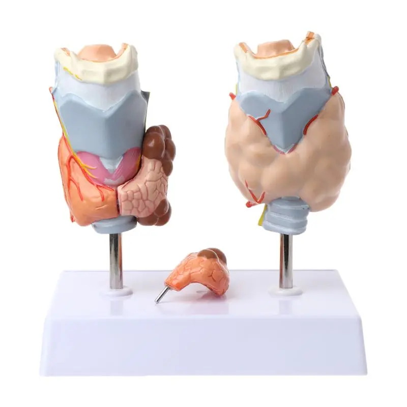 

Анатомическая патология щитовидной железы человека, модель для нормальных и болезненных заболеваний, медицинский обучающий инструмент