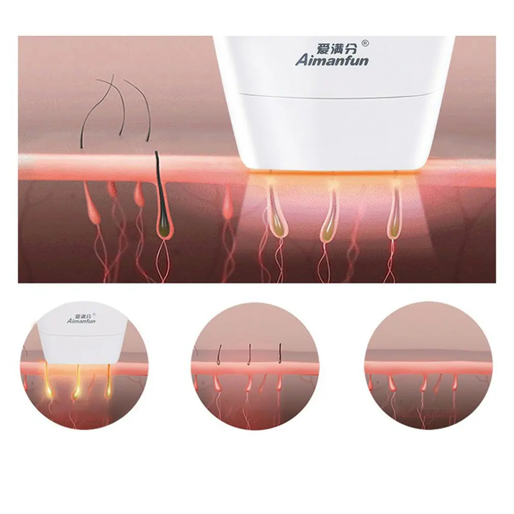 

Photon epilator Laser Hair Removal Apparatus Home Full-body Photon Epilator Underarm Shaver Lip Hair Removal Apparatus