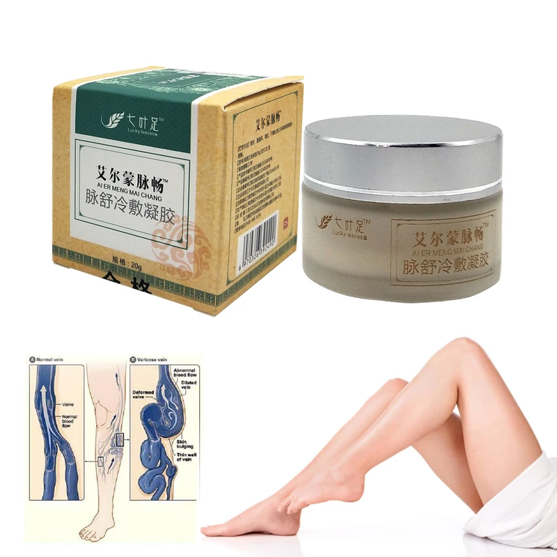 

New vasculitis treatment Phlebitis Angiitis inflammation blood vessel Rotten legs Varicose Veins ointment Varicose Veins Cream
