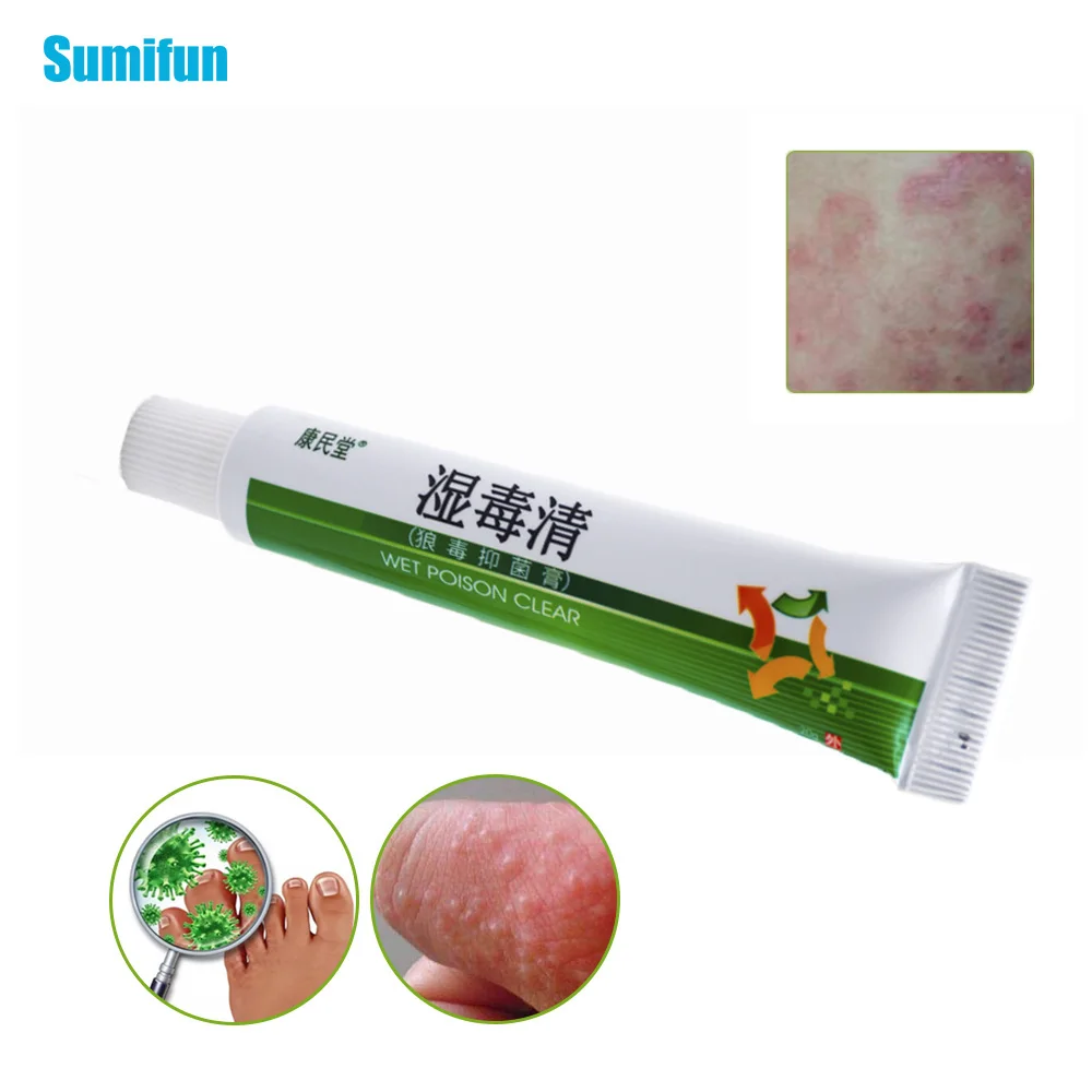 Sumifun, 1 шт., мазь для экземы, псориаз, крем, зудящая кожа, уход за зудящей кожей, китайский натуральный из трав, медицинская штукатурка P1015