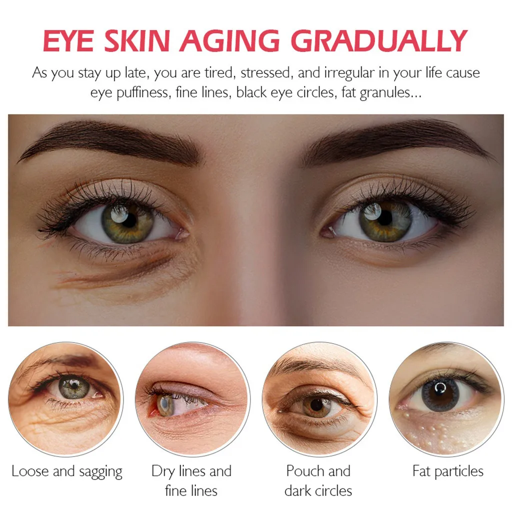 Крем для области вокруг глаз от Тёмных кругов припухлости и морщин| |