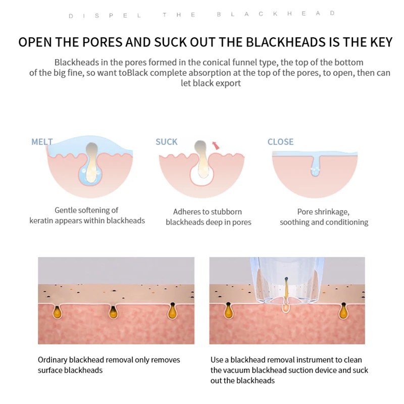 Электрический прибор для очистки пор от угрей с дисплеем подогревом CE/FCC | Красота