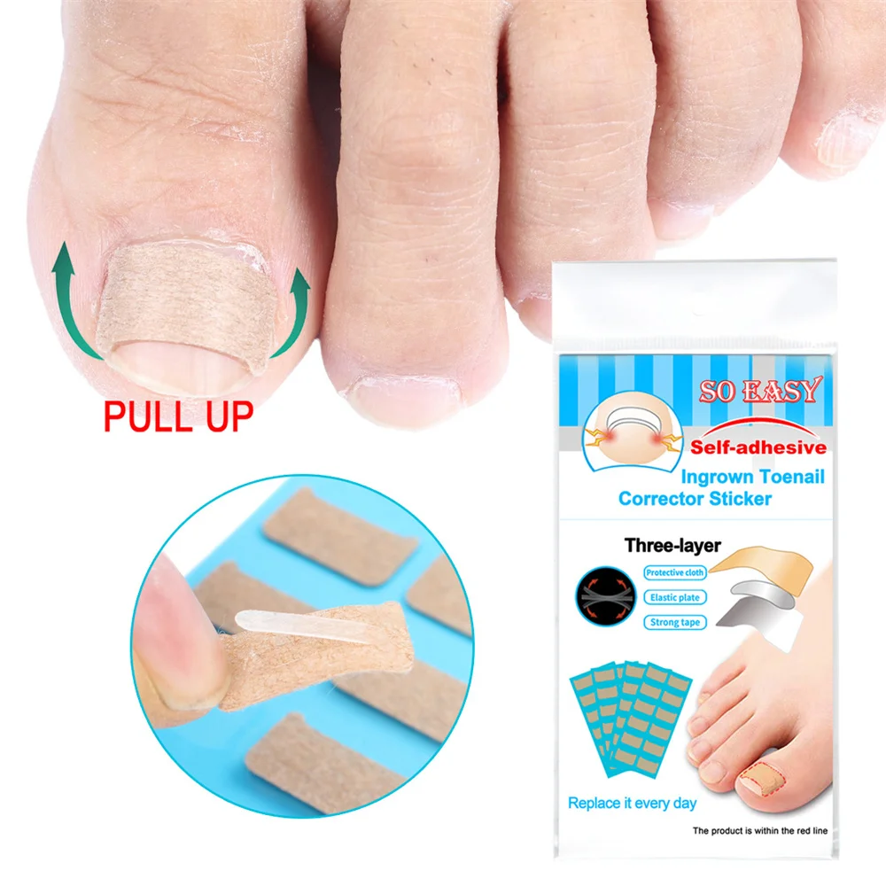 36pcs Ingrown Toenail Correction Stickers Nail Corrector Patches Paronychia Treatment Recover Sticker Pedicure Foot Care Tools - купить по