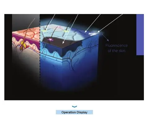 Новинка 2020 высококачественный анализатор влажности кожи аппарат для анализа