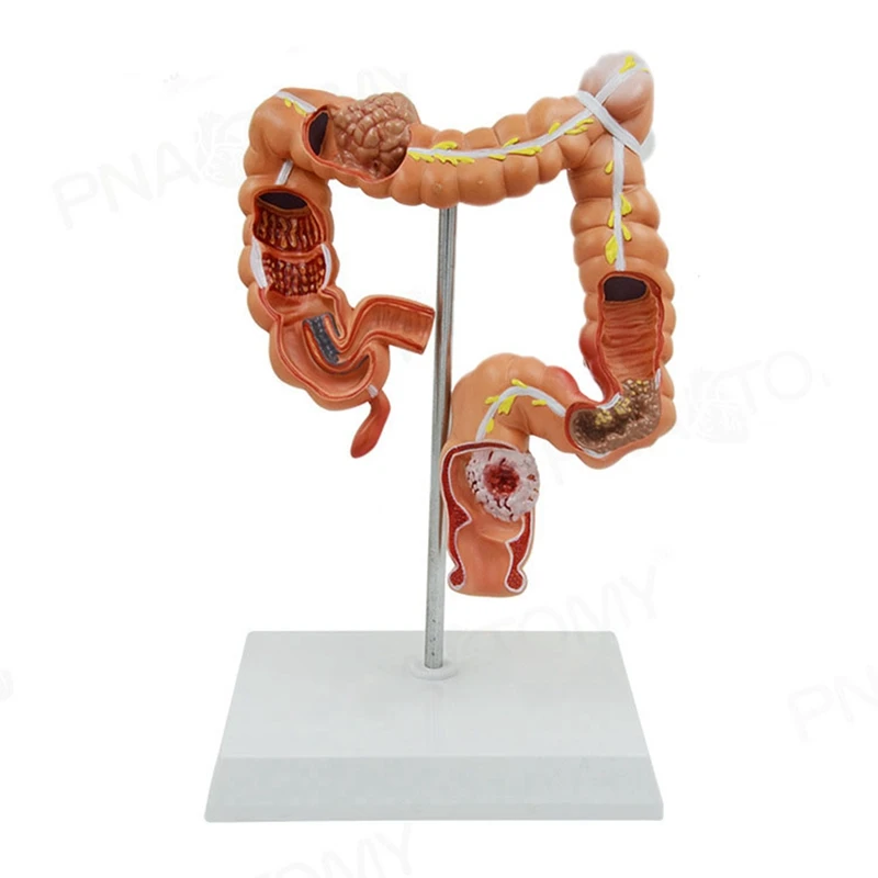 

Teaching Model Human Large Intestine Anatomical Model Visceral Colon and Rectum Pathological Model for School