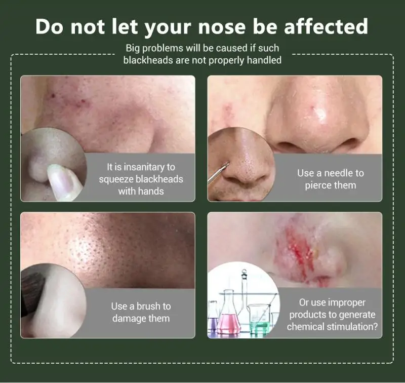 Маска для удаления черных точек LANBENA 50 г бамбуковый уголь маска глубокого