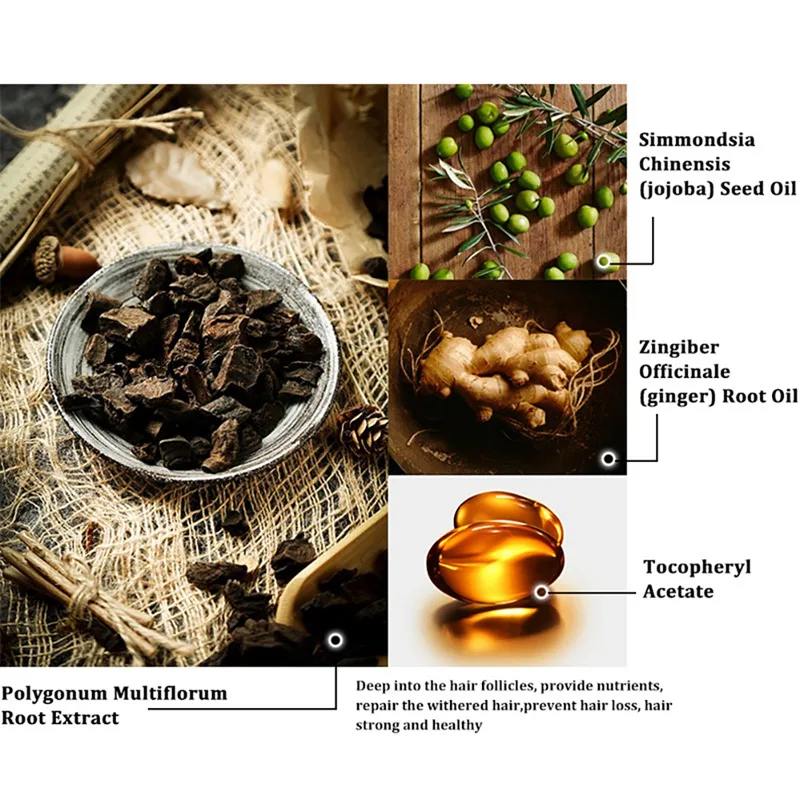 

Hair Growth Thicken Essential Oil Nourishing Scalp Repair Dyeing Perming Anti-hair Loss Hair Regrowth Oil