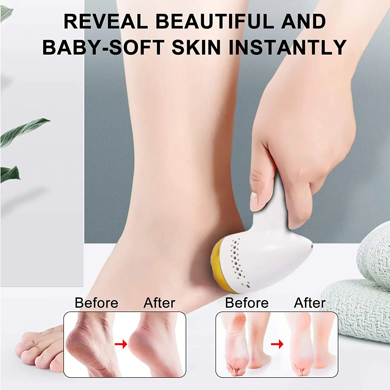 

Electric Foot Files Vacuum Pedicure Tools Dead Skin Callus Remover USB Foot Grinding Absorbing Machine Portable Foot Care Tool