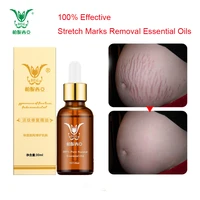 stretch marks removal essential oils pure natural stretch marks remover obesity postpartum anti wrinkle repair cream skin care